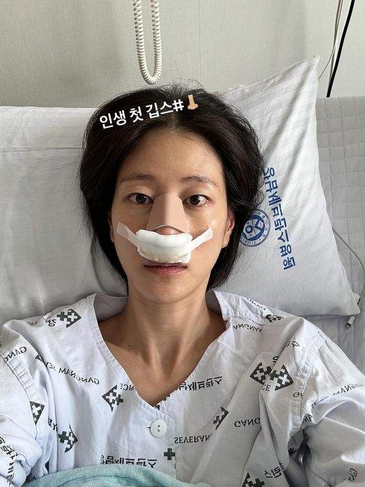 "의욕이 너무 앞섰다" <b>이현이</b> 축구 중 <b>코뼈 골절</b>! '골때녀' 프로... 