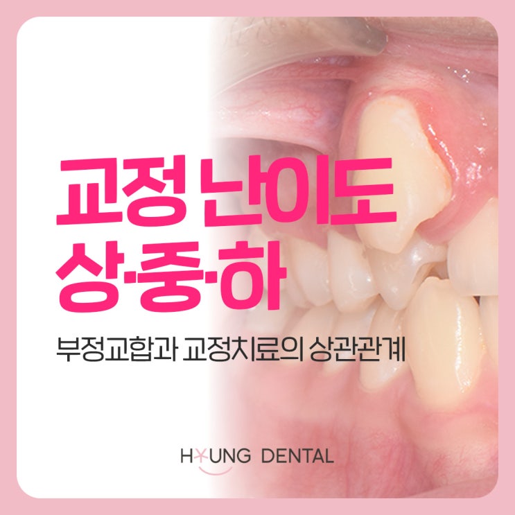  수원 권선구 치과 : 교정 난이도의 차이, 쉬운 교정이 있을까?