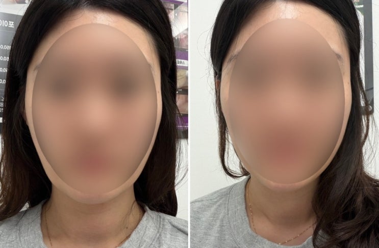  대구 남구 대명동 월배 [라플러스에스떼 후기] 작은 얼굴 관리부터 수분 케어, 경락, 웨딩관리
