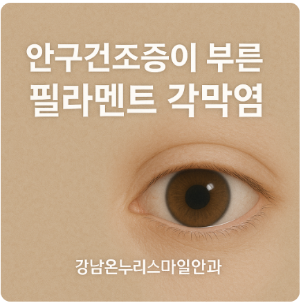 안구건조증이 부른 고통, ‘필라멘트 각막염’