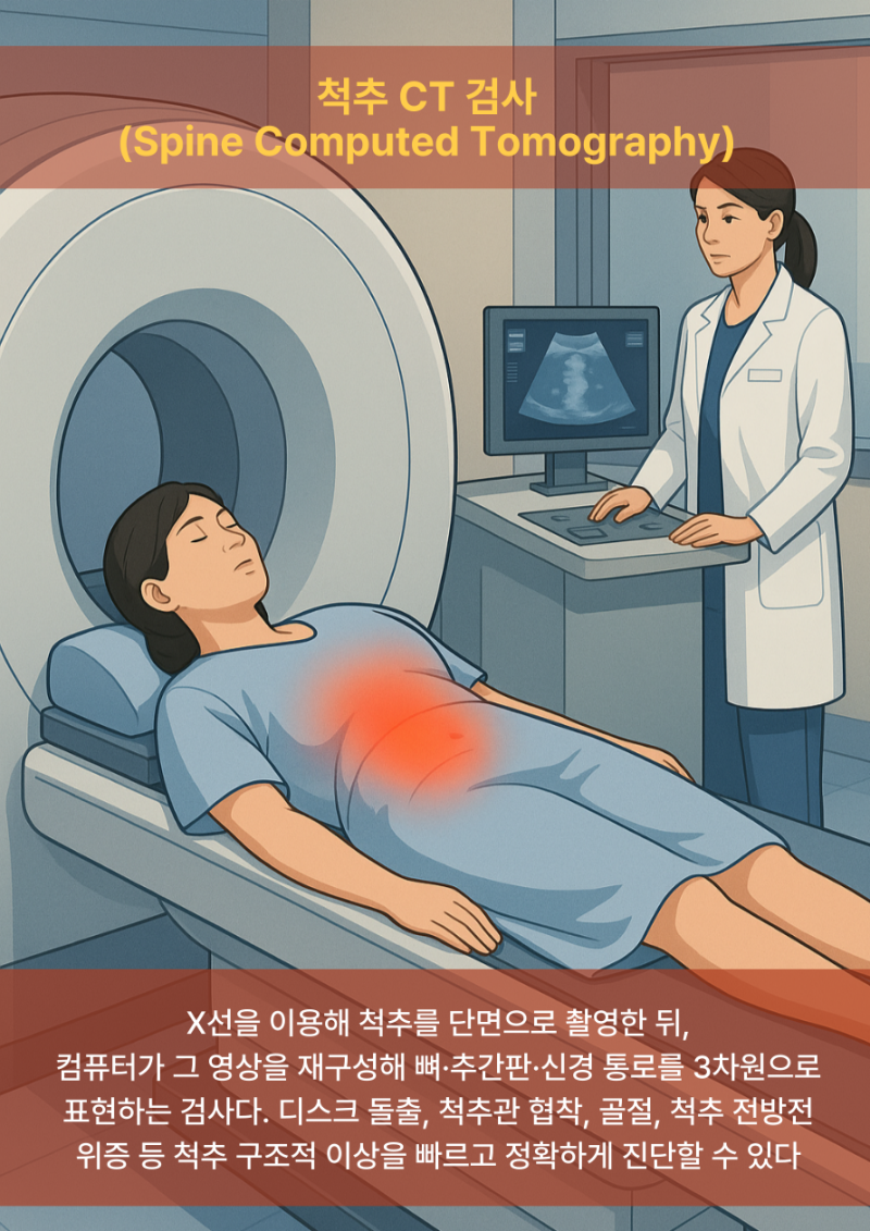 척추 CT검사, 신경 압박과 뼈 변화를 한눈에 본다