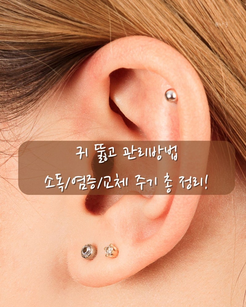 귀뚫고 관리 소독, 염증, 교체 방법 총정리