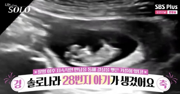  나는솔로 28기 ‘2세 임신’… 초음파 공개된 ‘나솔이’ 정체는? 광수·영숙 눈물, 정숙·상철 추측까지 ㄷㄷ 