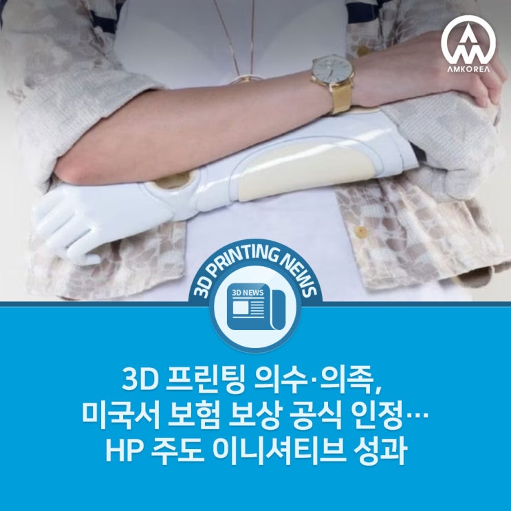  [3D 프린팅 뉴스] 3D 프린팅 의수·의족, 미국서 보험 보상 공식 인정…HP 주도 이니셔티브 성과