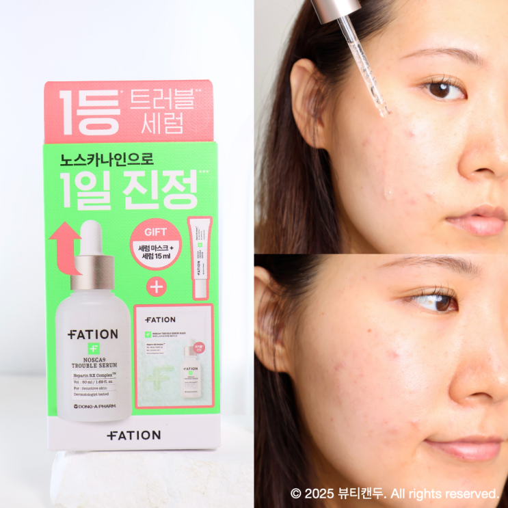  파티온 노스카나인 올리브영 트러블 세럼 내돈내산 2주 피부 추천