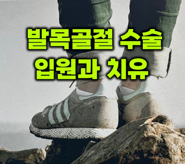 발목골절 수술 입원기간과 후기 봤더니