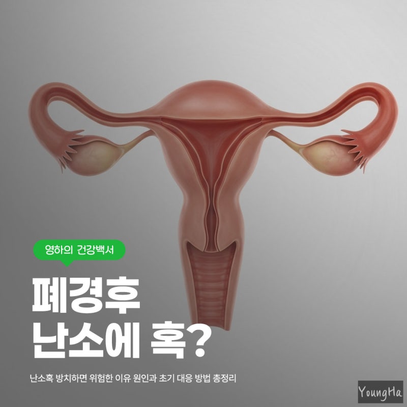 폐경후 난소혹 발견됐다면 반드시 알아야 할 점