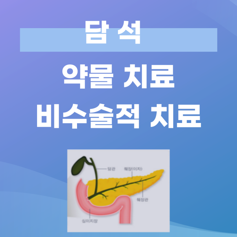 모든 담석이 수술 대상은 아니다 — 약으로 담석 치료하기 (대구 담석 전문 교수)