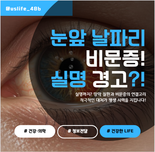 눈앞 날파리? 비문증이 실명 위험 신호일 때 꼭 체크할 3가지!