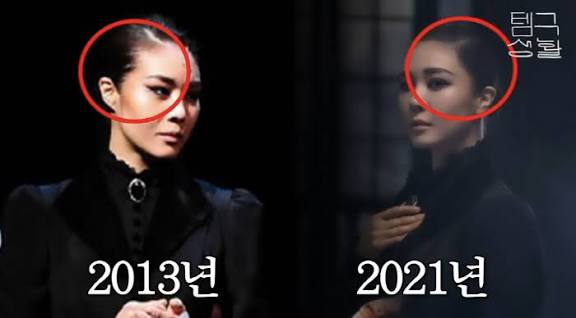 “잔머리 실종” <b>옥주현</b>이 털어놓는 <b>모발 이식</b>의 리얼토크