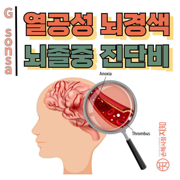  열공성 뇌경색 진단 후 뇌졸중진단비 분쟁, 약관은 비슷해도 다 다르게 해석하네요. - [보험금, BA+DA]