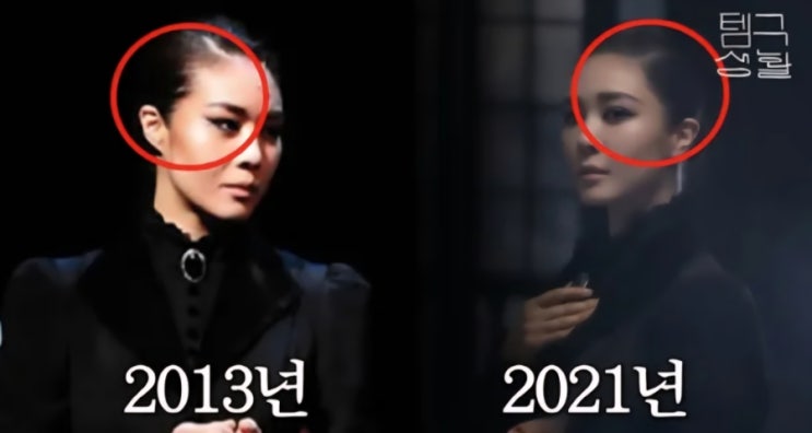 <b>모발 이식</b> 후 '잔머리 실종' 충격?! <b>옥주현</b>이 고백한 뜻밖의... 