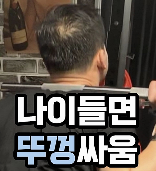  강릉두피문신 헤어라인 디자인 잘하는 곳 (ft.다크라인)