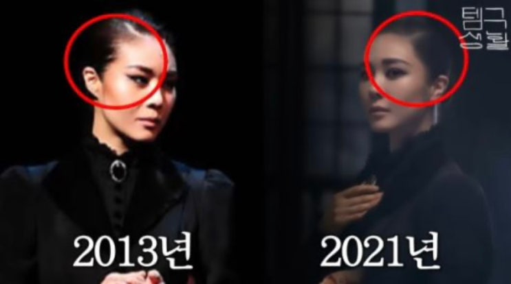 <b>옥주현</b> 탈모 고백과 <b>모발이식</b> 경험 공개 진짜 효과 본 헤어케어... 