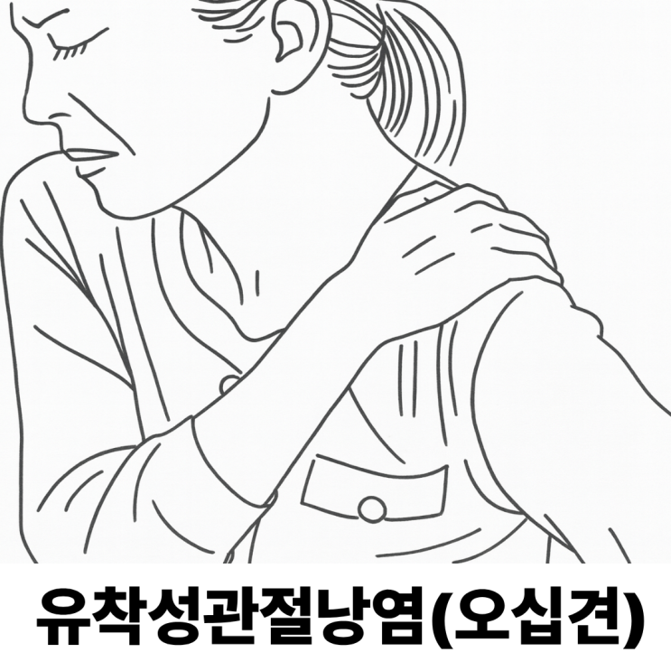  어깨가 굳고 아프다면 유착성관절낭염!