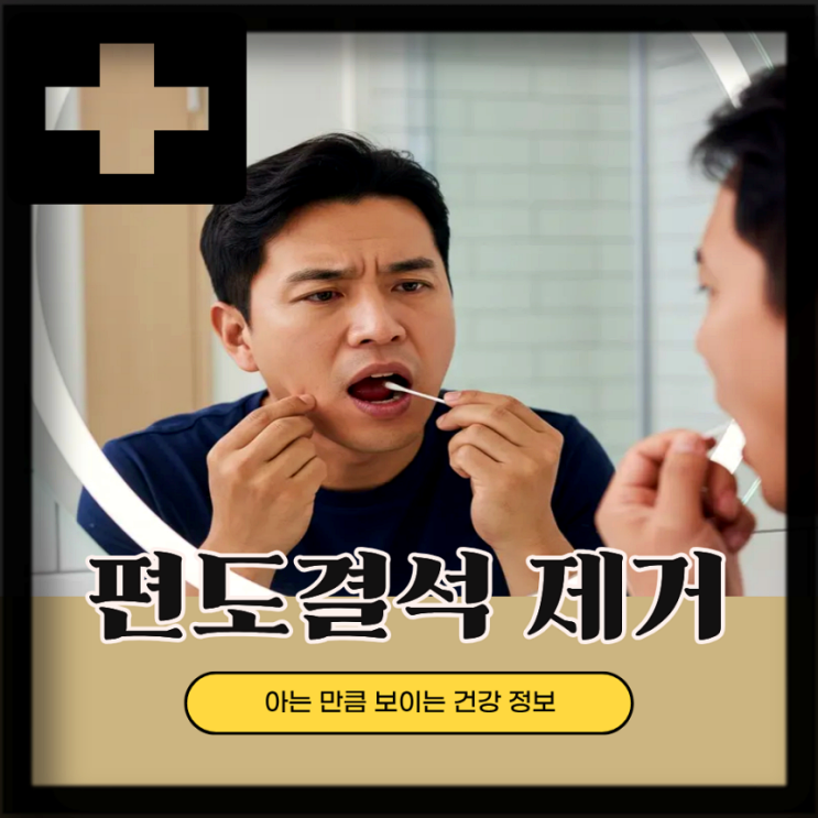  편도결석 원인 증상, 편도결석 쉽게 빼는법 5가지