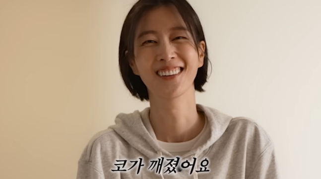 이현이 코뼈 골절 근황, "한 달 칩거 후 복귀" 부상 전말 공개