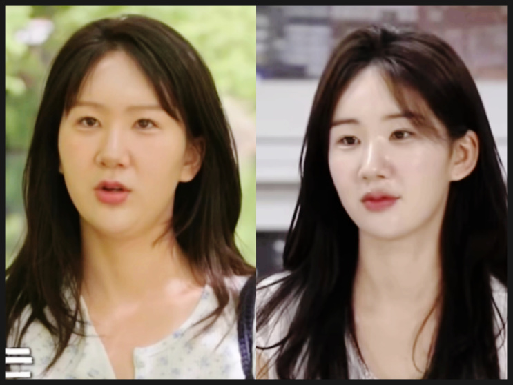  옥순리프팅 요즘 문의가 너무 많죠