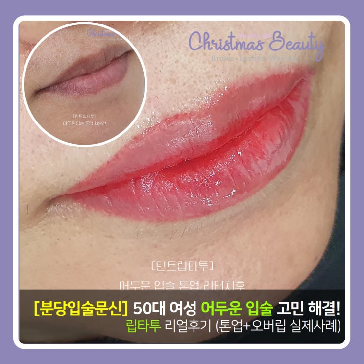  분당 입술문신 50대 여성 어두운 입술 고민 해결! 립타투 리얼후기 (톤업+오버립 실제사례)