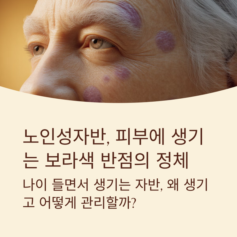 노인성자반, 피부에 생기는 보라색 반점의 정체
