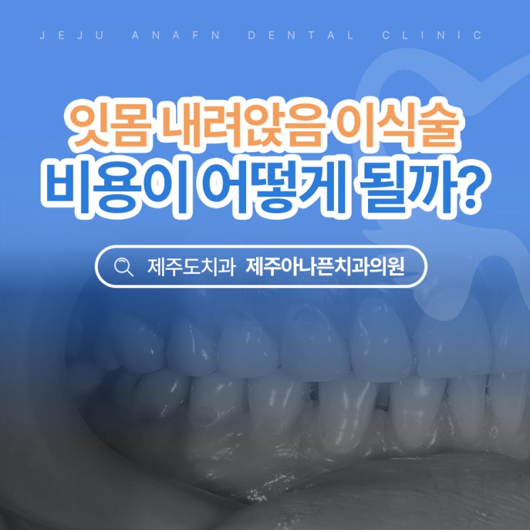 제주 노형동치과 잇몸 내려앉음 이식술 비용이 궁금하다면