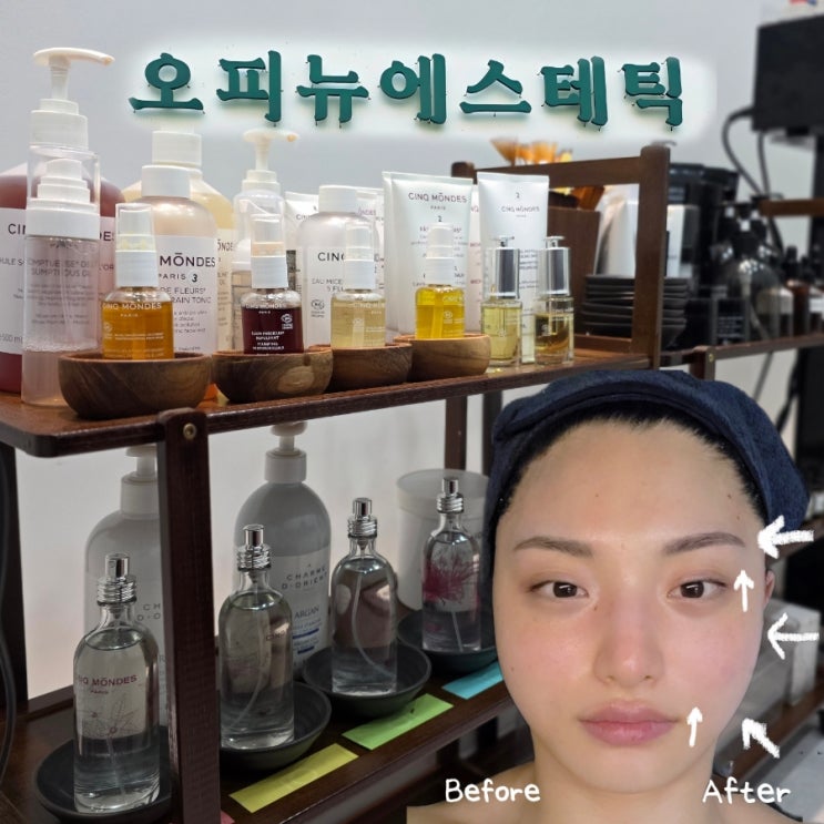  얼굴복원테크닉 대구다사피부관리 오피뉴에스테틱 관리후기