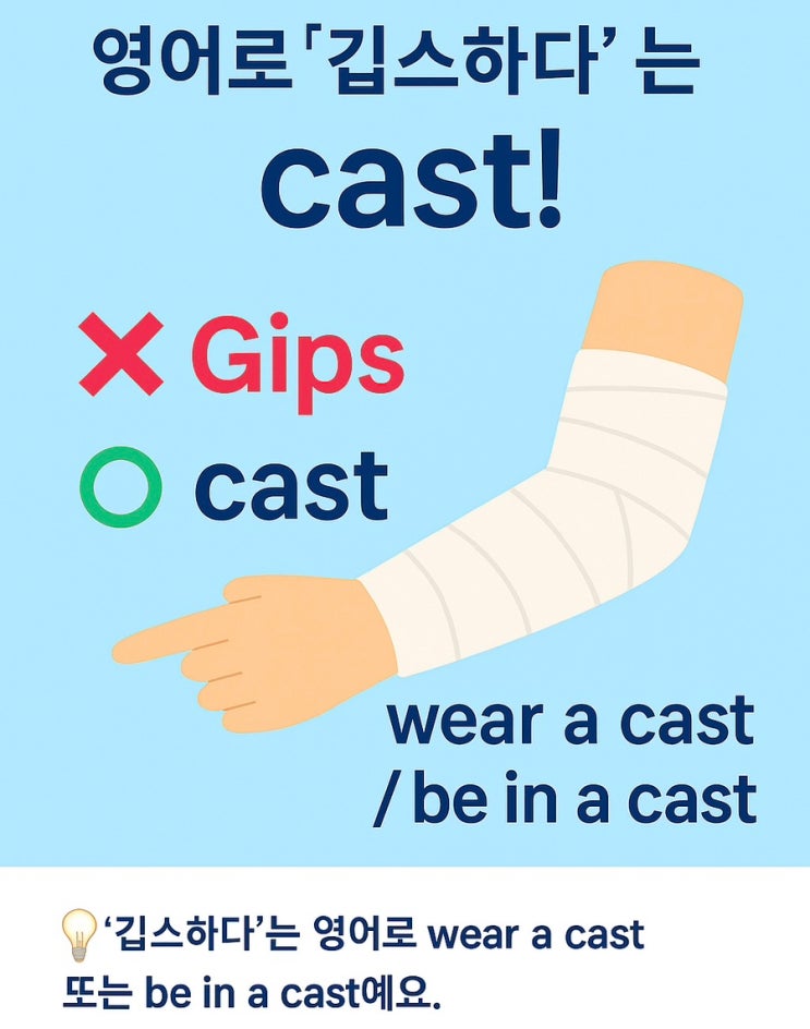  영어로 ‘깁스하다’? — Gips  vs cast 