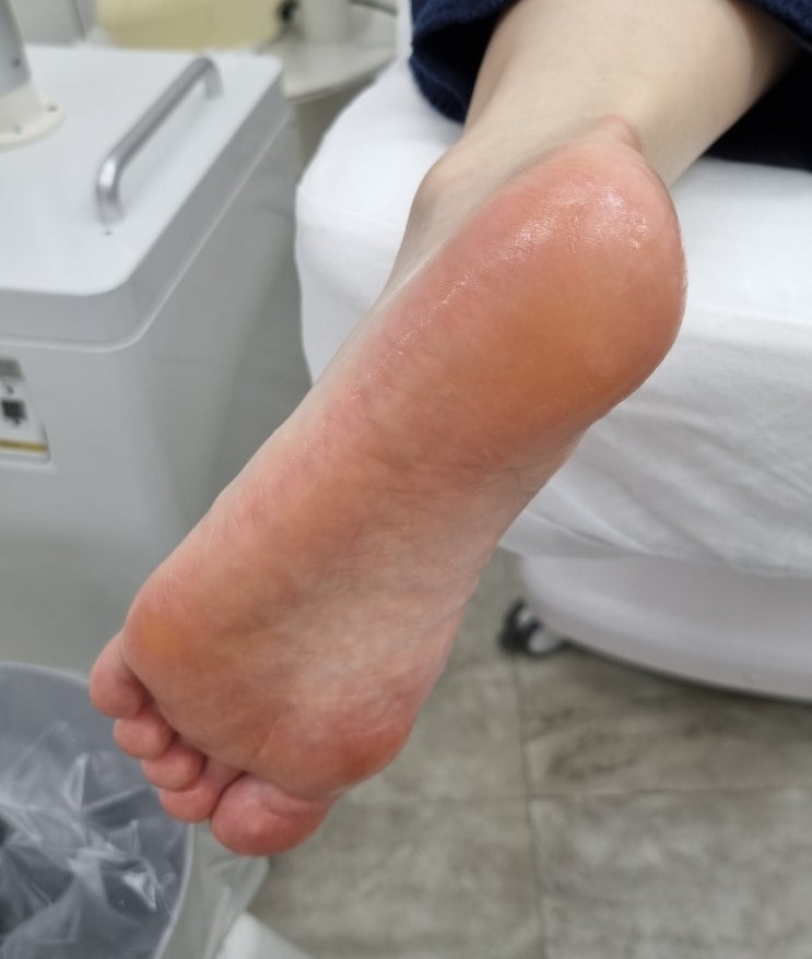 용인 기흥 발각질제거는 푸스케어 용인기흥점