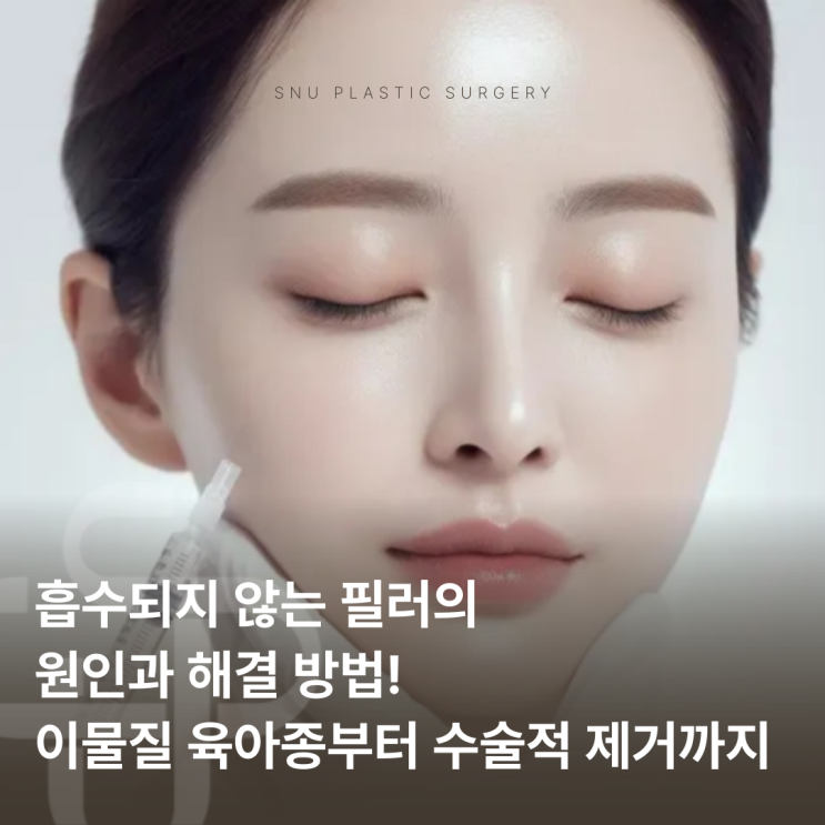  흡수되지 않는 필러, 원인은 무엇일까? 해결 방법