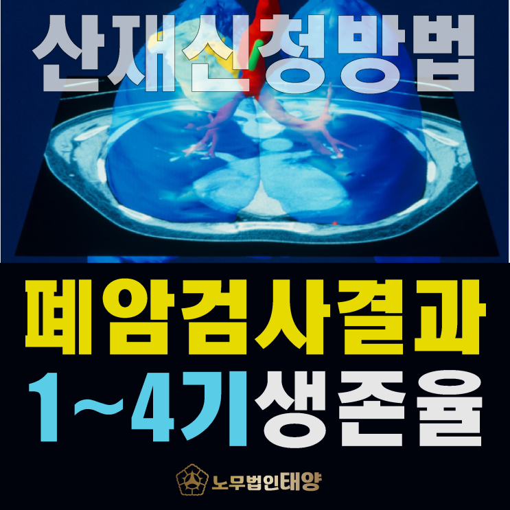  [폐암 검사 결과] 1기~4기 생존율 기간, 원인 직업병 산재 신청 방법