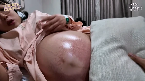  임라라 쌍둥이 출산 비하인드 피부 시련 이겨낸 감동 이야기