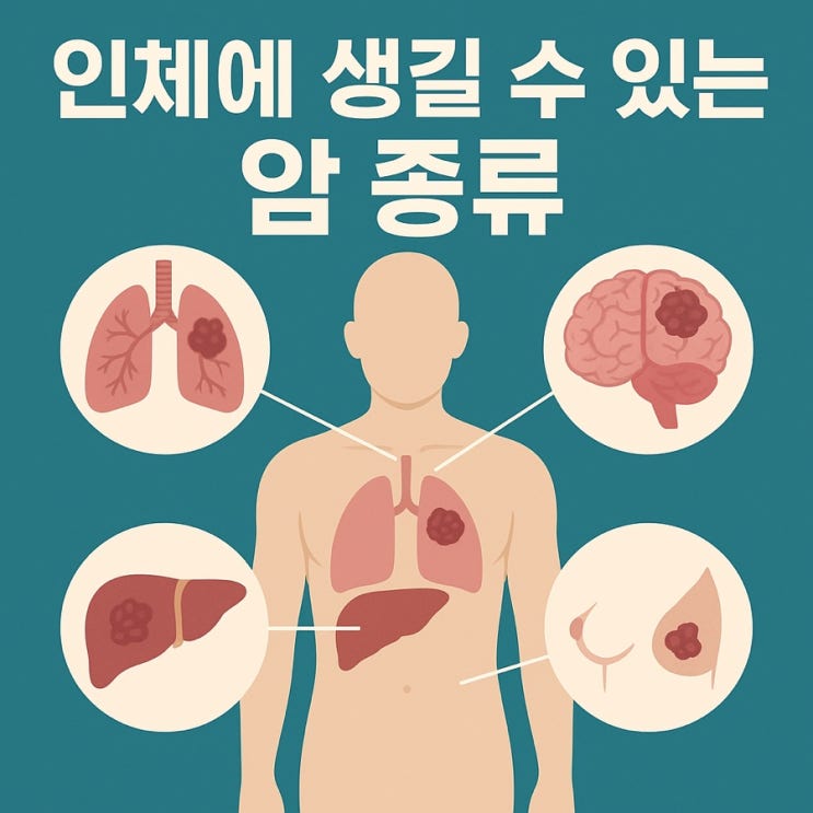  인체에 생길 수 있는 암 종류 총정리 | 부위별·조직별로 알아보는 암의 모든 것