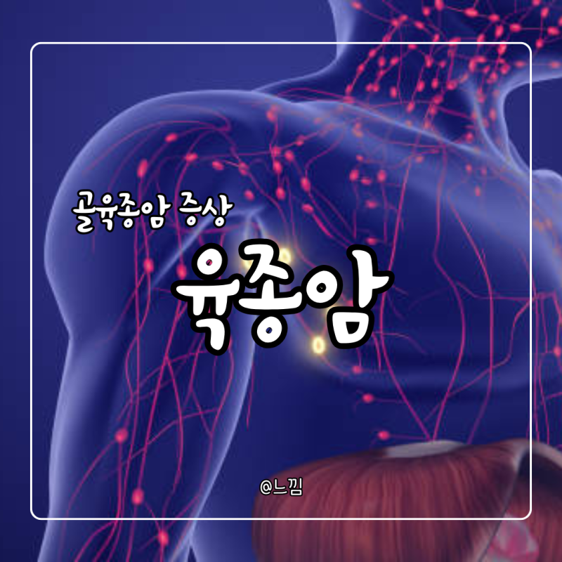 육종암 골육종암 증상 및 원인 치료