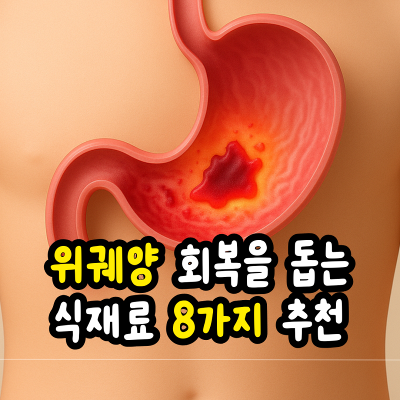 위궤양에 좋은 음식 8가지, 양배추부터 프로바이오틱까지