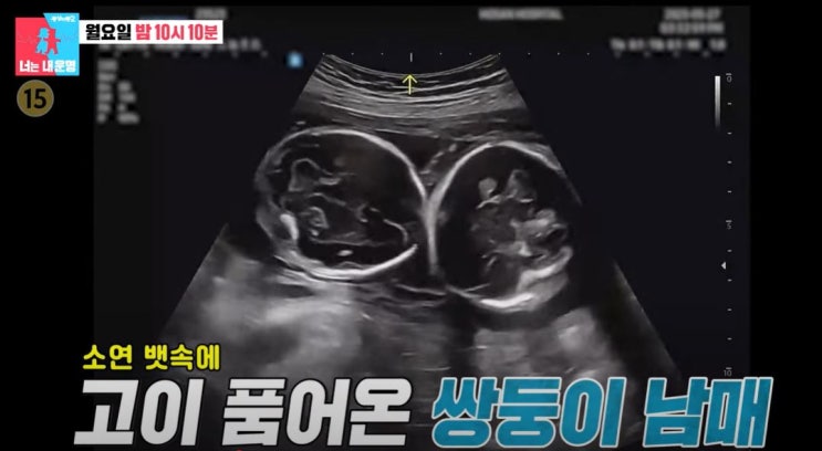 <b>송재희 지소연 쌍둥이</b> 출산 비하인드 동상이몽2 410회 총정리