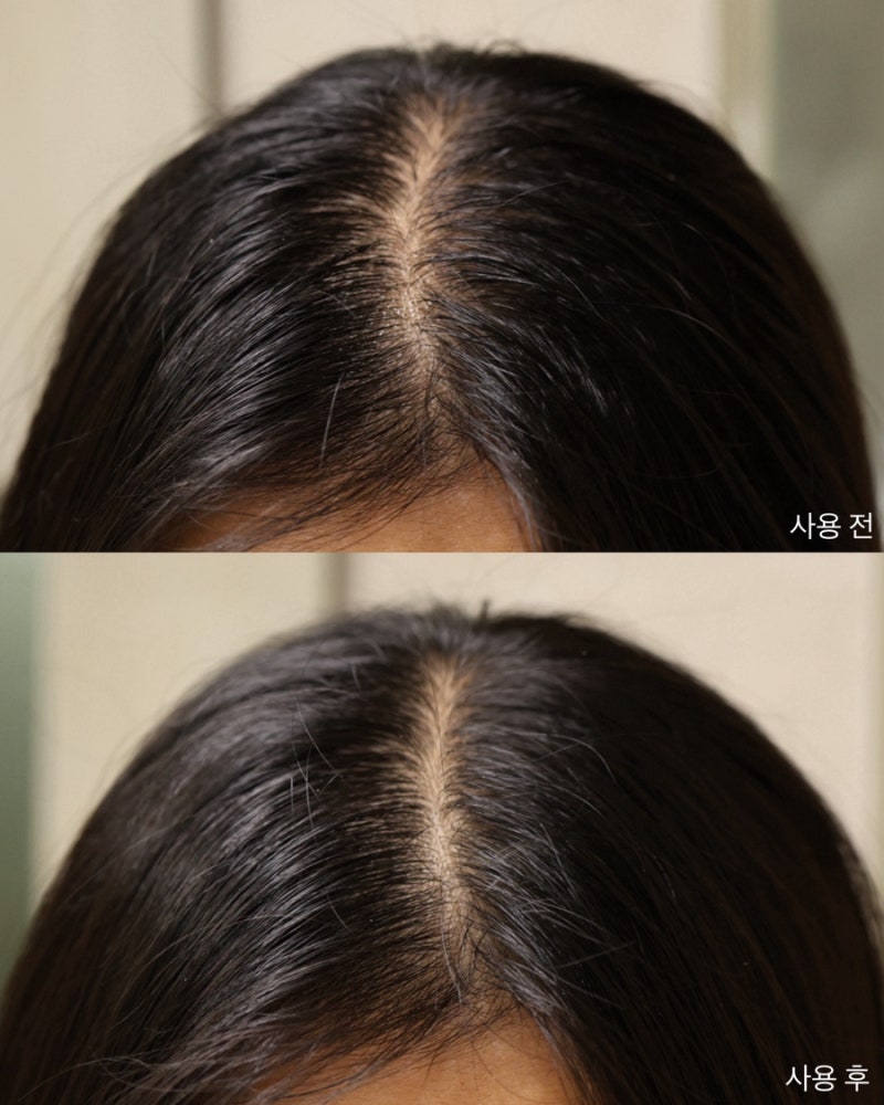 헤어라인 관리 올리브영 라우쉬 카페인샴푸, 헤어토닉 2주 후기