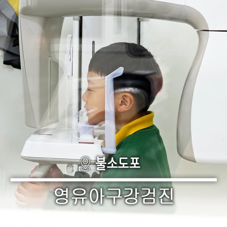  영유아구강검진 어린이치과 불소도포 충치치료 웃음가스 키즈치과