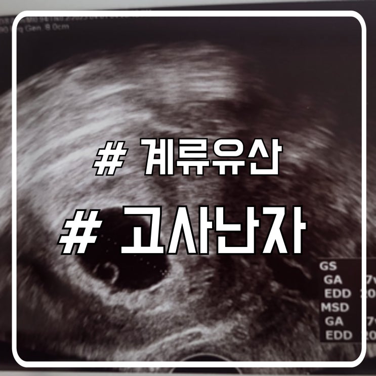  계류유산 원인과 관리｜고사난자 시 소파술