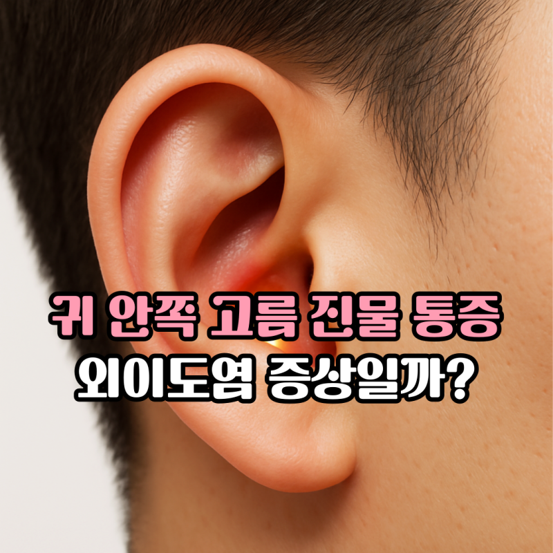 귀 안쪽 고름 진물 나오고 통증 외이도염 증상일까?