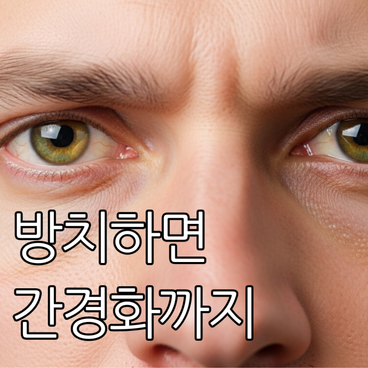  방치하면 '간경화'까지...  직장인이 꼭 알아야 할 '황달 증상'의 모든 것