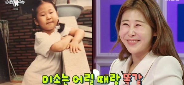 <b>성형 고백</b> <b>박세미</b>의 솔직한 이야기와 그 이면
