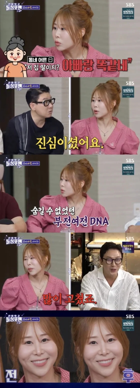 <b>박세미</b>, “너무 못생겨서 아빠가 부정했대요”…<b>성형</b> 전 과거... 