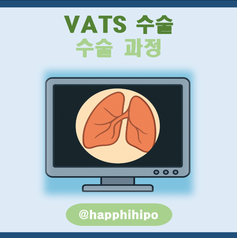 의학용어 VATS란? VATS 수술, OP, 적응증, 수술 과정procedure, 수술 후 간호 총정리 : 네이버 블로그