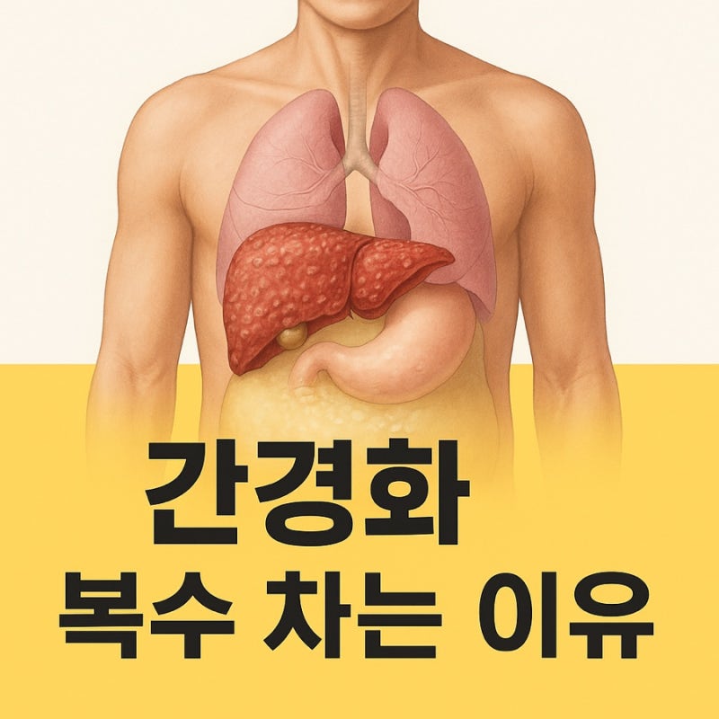 알콜성 간경화 증상 간경화 복수 차는 증상 주의깊게 봐야 합니다