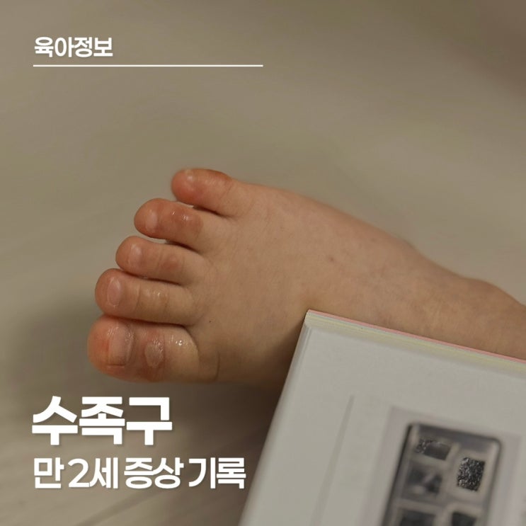  만2세 아이 수족구 증상 기록