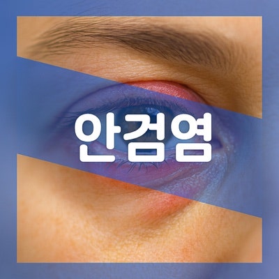 안검염 다래끼 차이, 원인 증상 레이저 치료 알아보자
