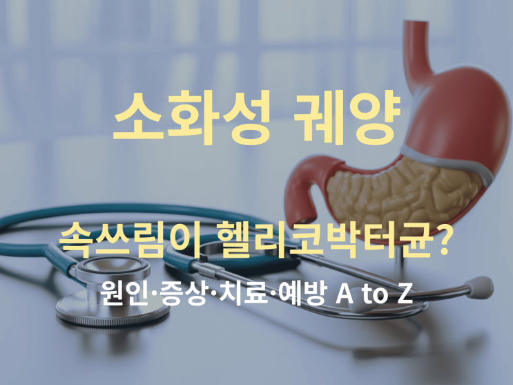  소화성 궤양, 속 쓰림이 헬리코박터균? 원인·증상·치료·예방 A to Z