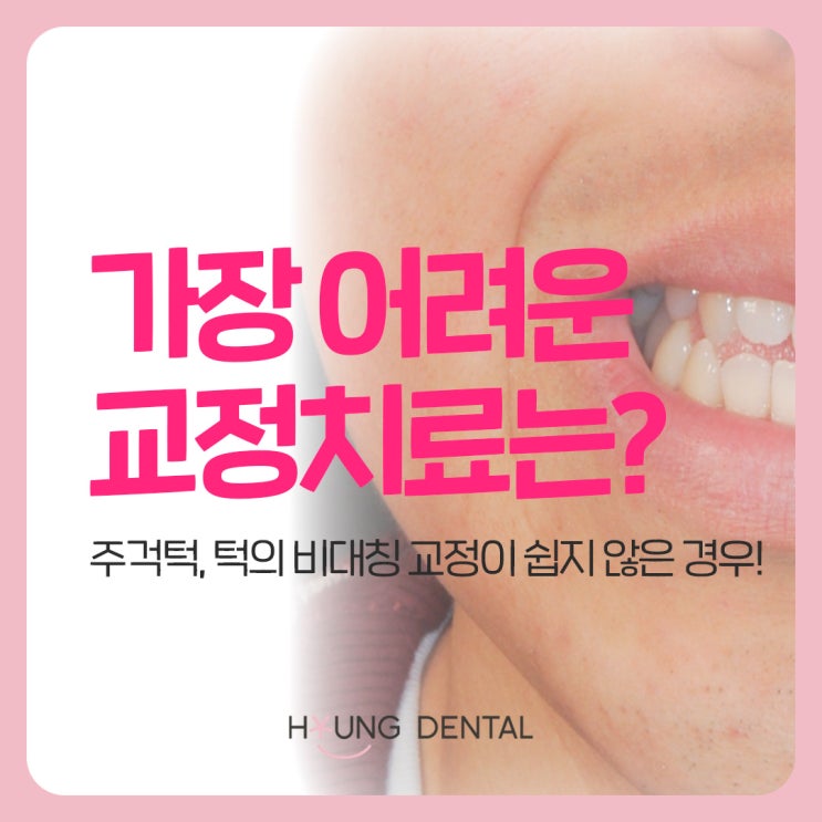  가장 어려운 교정치료? 영덕동 치과가 답합니다