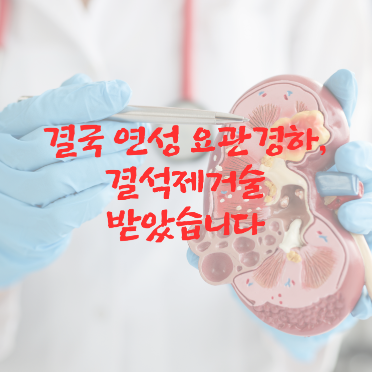 결국 연성 요관경하 결석제거술 받았습니다