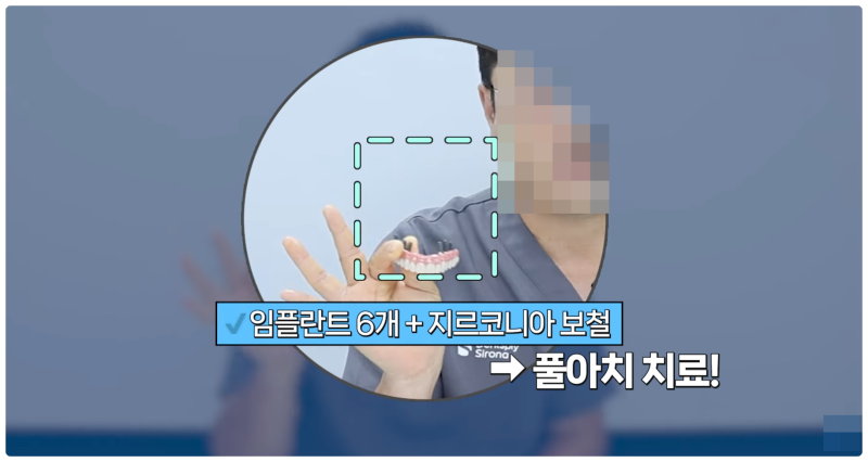 노인임플란트 가격? 최소 200만 원 줄이는 방법